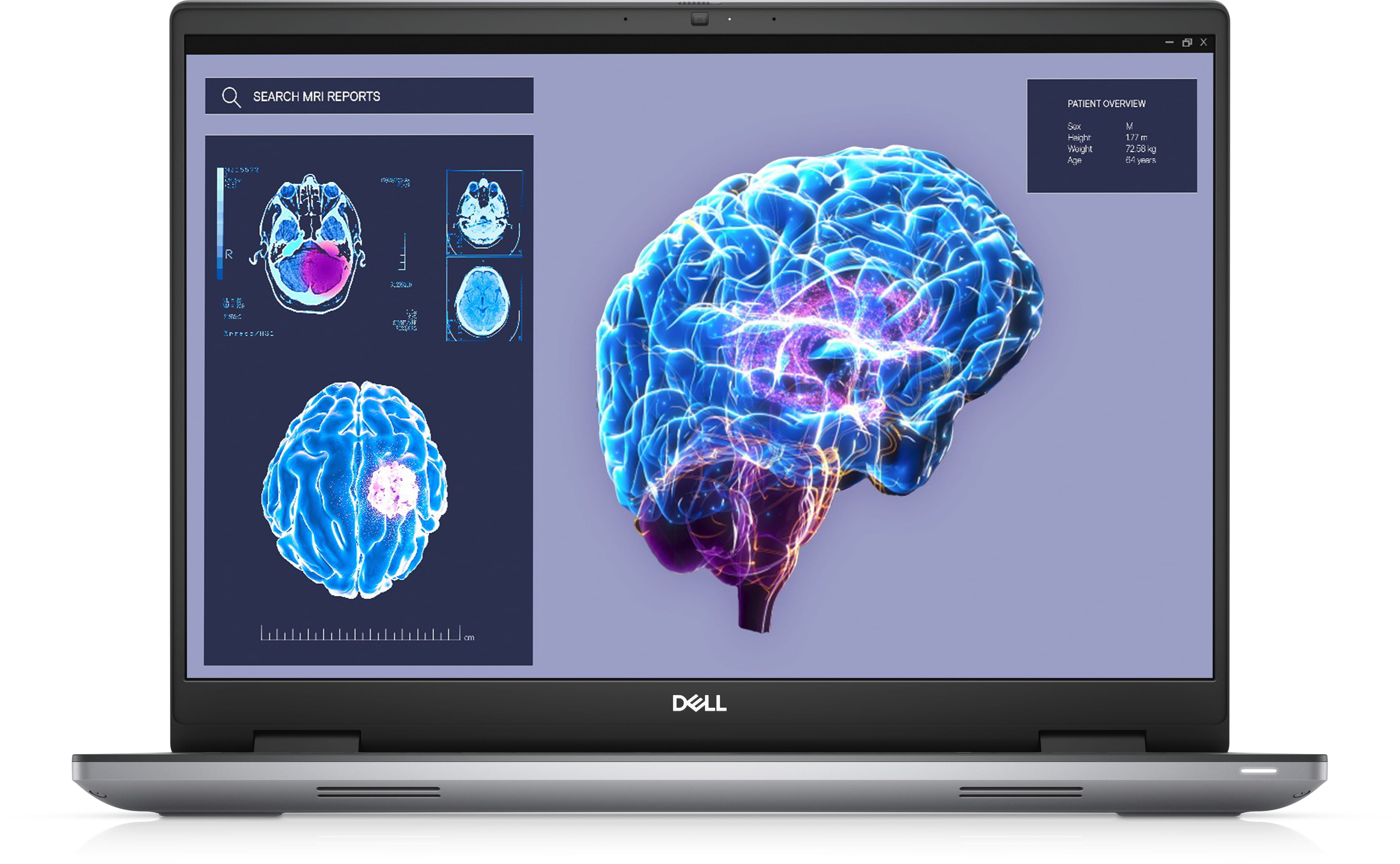 Dell Precision 7680 - Intel Core i9 13950HX / 2.2 GHz - Win 11 Pro - NVIDIA RTX 3500 Ada - 32 GB RAM - 1 TB SSD NVMe, Class 40 - 40.64 cm (16")